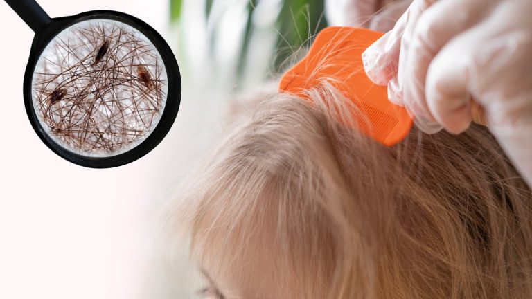 Are Lice Harder To Find In Curly Hair?