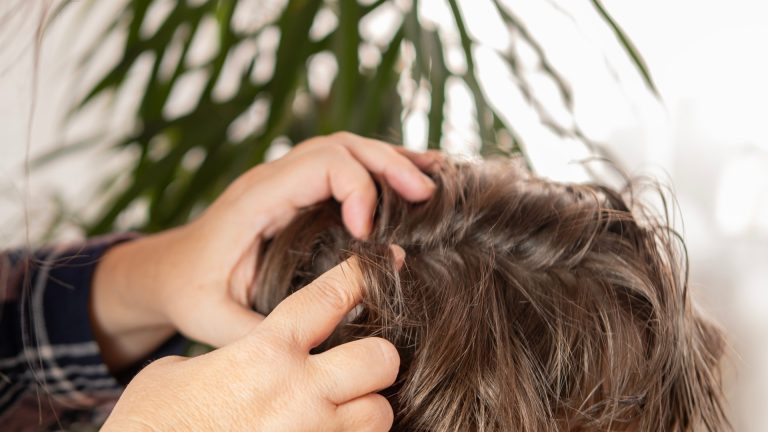 Should You Get A Lice Check Before Summer Camp?
