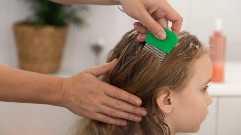 Lint, Scab, or Louse: What’s in Your Child’s Hair?