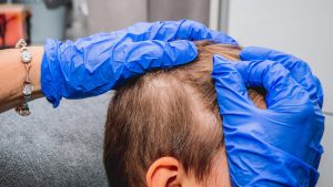 Parent gently inspecting a child's scalp under bright light a few days after a lice treatment