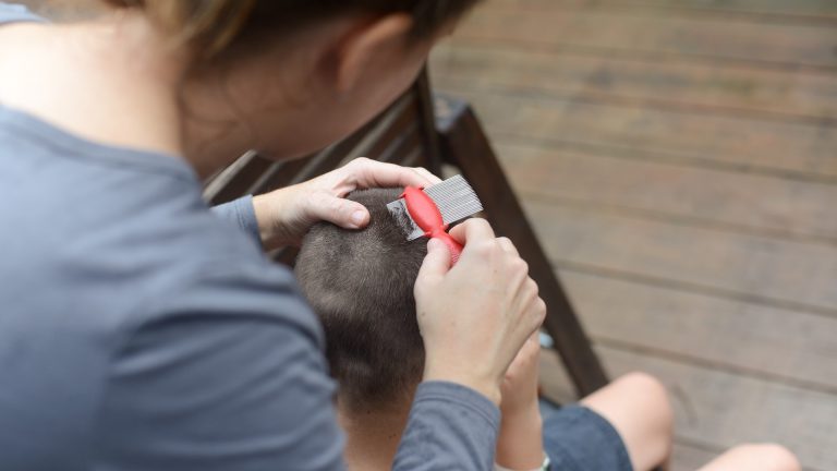 The Nits Most Home Comb-Outs Leave Behind