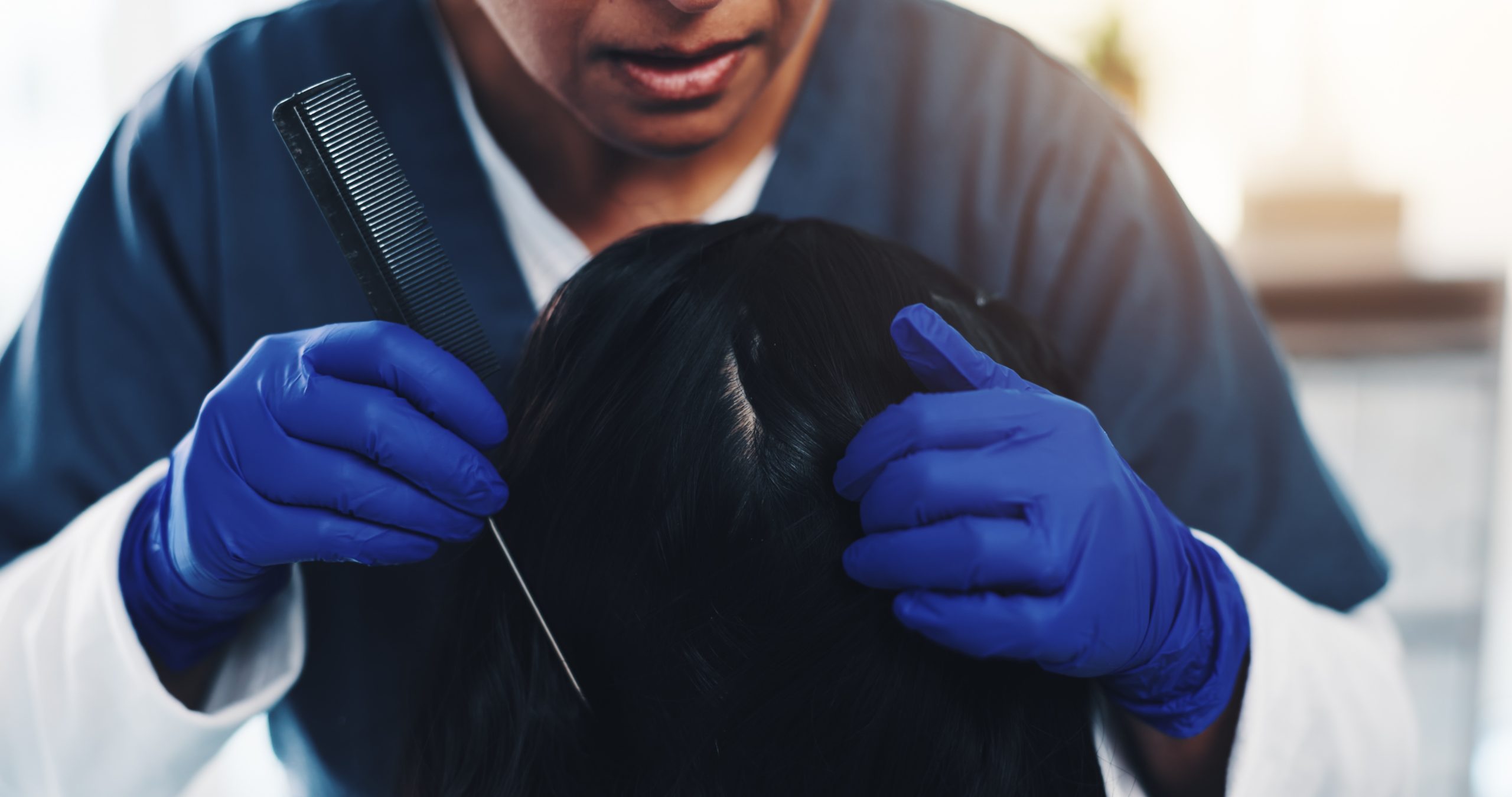 Hands, healthcare and scalp of child with doctor in hospital for appointment, checkup or treatment. Hair, head or medical with patient and trichologist ... See More
