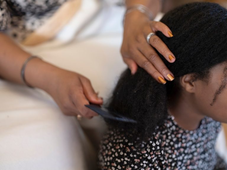 Lice Don’t Cause Hair Loss. Scratching and Combing Can.